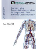 Complex Hybrid Revascularization Procedures - videocorso