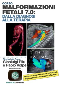 Dalla diagnosi alla prognosi delle malformazioni fetali 7.0 2