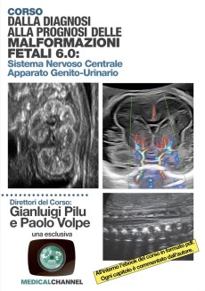 Dalla diagnosi alla prognosi delle malformazioni fetali 6.0 2