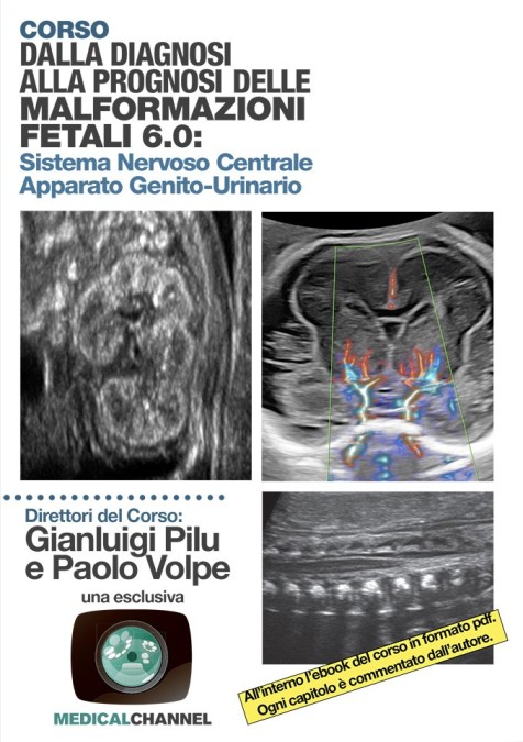 Dalla diagnosi alla prognosi delle malformazioni fetali 6.0