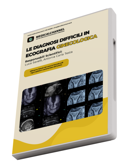 Diagnosi difficili in ecografia ginecologica