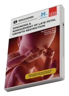 Diagnosis & management of late fetal growth restriction